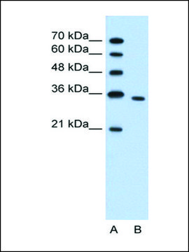 Anti-PRPS2 antibody produced in rabbit IgG fraction of antiserum