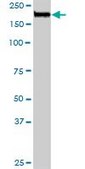 Anti-NUMA1 antibody produced in rabbit purified immunoglobulin, buffered aqueous solution