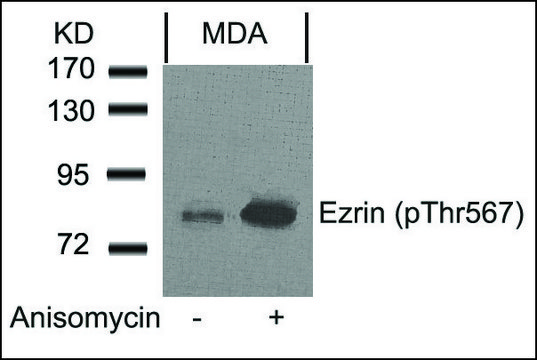 Anti-phospho-EZR (pThr567) antibody produced in rabbit affinity isolated antibody