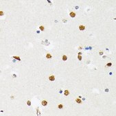 Anti-PTBP2 antibody produced in rabbit