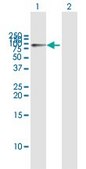 Anti-HK1 antibody produced in mouse purified immunoglobulin, buffered aqueous solution