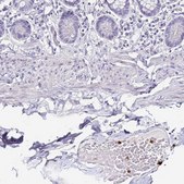 Anti-TLR4 antibody produced in rabbit Prestige Antibodies&#174; Powered by Atlas Antibodies, affinity isolated antibody, buffered aqueous glycerol solution