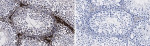 Anti-IDH1 Antibody, clone 1M9 ZooMAb&#174; Rabbit Monoclonal recombinant, expressed in HEK 293 cells