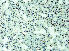 Anti-acetyl-Histone H3 (Ac-Lys9) antibody produced in rabbit 2-2.5&#160;mg/mL, affinity isolated antibody, buffered aqueous solution