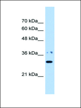 Anti-NMNAT1 IgG fraction of antiserum