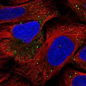 Anti-IRAK2 antibody produced in rabbit Prestige Antibodies&#174; Powered by Atlas Antibodies, affinity isolated antibody, buffered aqueous glycerol solution