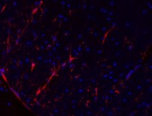 Anti-GFAP Antibody, Cy3 Conjugate from mouse, CY3 conjugate