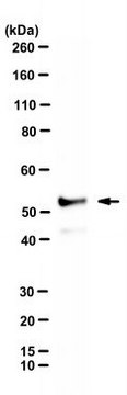 Anti-RIPK3/RIP3 Antibody, clone 8G7