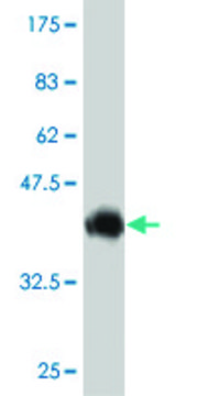 Monoclonal Anti-ABCC6 antibody produced in mouse clone 5D8, purified immunoglobulin, buffered aqueous solution