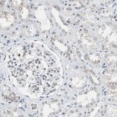 Anti-TOP2A antibody produced in rabbit Prestige Antibodies&#174; Powered by Atlas Antibodies, affinity isolated antibody, buffered aqueous glycerol solution, Ab1