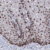 Anti-HMGA1 antibody produced in rabbit Prestige Antibodies&#174; Powered by Atlas Antibodies, affinity isolated antibody, buffered aqueous glycerol solution