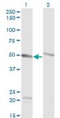 Monoclonal Anti-TUBA6 antibody produced in mouse clone 1D2-H5, purified immunoglobulin, buffered aqueous solution