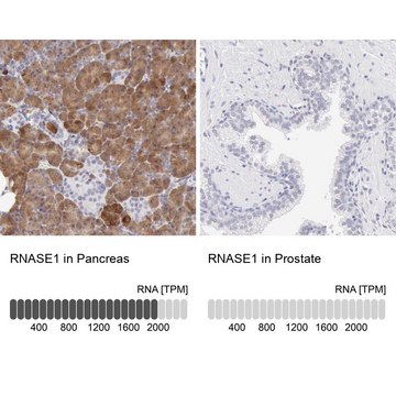 Anti-RNASE1 antibody produced in rabbit Prestige Antibodies&#174; Powered by Atlas Antibodies, affinity isolated antibody, buffered aqueous glycerol solution