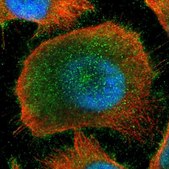 Anti-ZBTB33 antibody produced in rabbit Ab2, Prestige Antibodies&#174; Powered by Atlas Antibodies, affinity isolated antibody, buffered aqueous glycerol solution