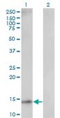 Monoclonal Anti-UBE2D1 antibody produced in mouse clone 2C6, purified immunoglobulin, buffered aqueous solution