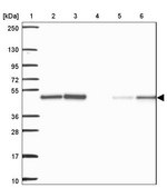 Anti-AGK antibody produced in rabbit Prestige Antibodies&#174; Powered by Atlas Antibodies, affinity isolated antibody, buffered aqueous glycerol solution