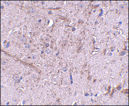 Anti-TOM70 antibody produced in rabbit affinity isolated antibody, buffered aqueous solution