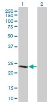 Anti-CSN1S1 antibody produced in rabbit purified immunoglobulin, buffered aqueous solution