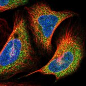 Anti-PRNP antibody produced in rabbit Prestige Antibodies&#174; Powered by Atlas Antibodies, affinity isolated antibody, buffered aqueous glycerol solution
