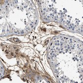 Anti-C3 antibody produced in rabbit Prestige Antibodies&#174; Powered by Atlas Antibodies, affinity isolated antibody, buffered aqueous glycerol solution