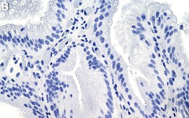 Anti-CTBP2 Antibody, clone 1C2 ZooMAb&#174; Rabbit Monoclonal recombinant, expressed in HEK 293 cells