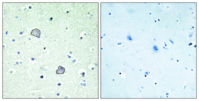 Anti-EDG2 antibody produced in rabbit affinity isolated antibody