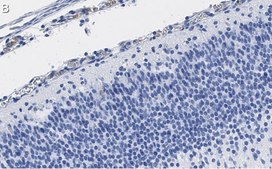 Anti-Reelin Antibody, clone G10 ZooMAb&#174; Mouse Monoclonal recombinant, expressed in HEK 293 cells