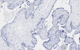 Anti-MOSPD2 Antibody, clone 3C20 ZooMAb&#174; Rabbit Monoclonal recombinant, expressed in HEK 293 cells