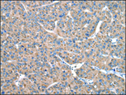 Anti-CASK affinity isolated antibody