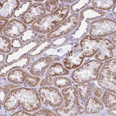 Anti-SLC13A1 antibody produced in rabbit Prestige Antibodies&#174; Powered by Atlas Antibodies, affinity isolated antibody, buffered aqueous glycerol solution