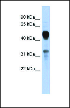 Anti-MVK antibody produced in rabbit affinity isolated antibody