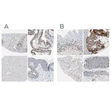 Anti-GRHL1 antibody produced in rabbit Ab2, Prestige Antibodies&#174; Powered by Atlas Antibodies, affinity isolated antibody, buffered aqueous glycerol solution