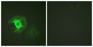 Anti-Caldesmon antibody produced in rabbit affinity isolated antibody