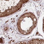 Anti-PSMA1 antibody produced in rabbit Prestige Antibodies&#174; Powered by Atlas Antibodies, affinity isolated antibody, buffered aqueous glycerol solution