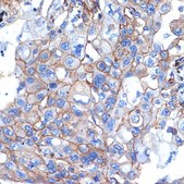 Anti-Talin 2 Antibody, clone 7D1Y0, Rabbit Monoclonal