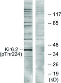 Anti-KIR6.2 (PHOSPHO-THR224) affinity isolated antibody