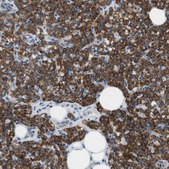 Anti-MARC2 antibody produced in rabbit Prestige Antibodies&#174; Powered by Atlas Antibodies, affinity isolated antibody, buffered aqueous glycerol solution
