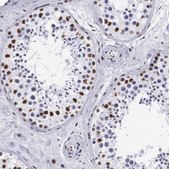 Anti-MECP2 antibody produced in rabbit Ab1, Prestige Antibodies&#174; Powered by Atlas Antibodies, affinity isolated antibody, buffered aqueous glycerol solution