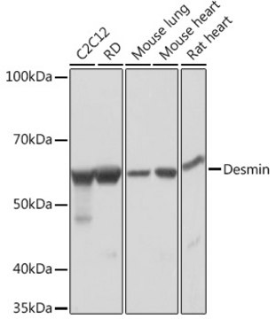 Anti-Desmin Antibody, clone 6O9O4, Rabbit Monoclonal