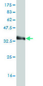 Monoclonal Anti-LHX3 antibody produced in mouse clone 2C10, purified immunoglobulin, buffered aqueous solution