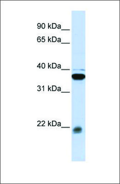 Anti-MYL9 antibody produced in rabbit affinity isolated antibody