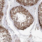 Anti-CARMIL1 antibody produced in rabbit Prestige Antibodies&#174; Powered by Atlas Antibodies, affinity isolated antibody, buffered aqueous glycerol solution, ab1