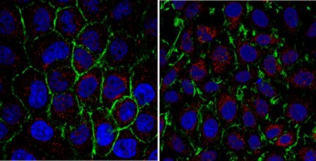 Anti-PSAT1 Antibody from rabbit, purified by affinity chromatography