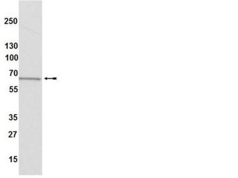 Anti-Estrogen Receptor &#945; Antibody, clone 60C, rabbit monoclonal culture supernatant, clone 60C, from rabbit