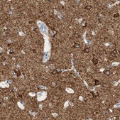 Anti-ATP2B1 antibody produced in rabbit Prestige Antibodies&#174; Powered by Atlas Antibodies, affinity isolated antibody, buffered aqueous glycerol solution
