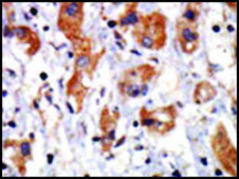 Anti-WNK1 (C-term) antibody produced in rabbit IgG fraction of antiserum, buffered aqueous solution