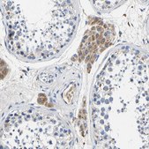 Anti-SLC25A25 antibody produced in rabbit Prestige Antibodies&#174; Powered by Atlas Antibodies, affinity isolated antibody, buffered aqueous glycerol solution