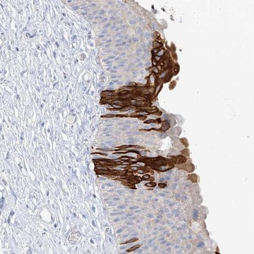 Anti-PAFAH1B3 antibody produced in rabbit Prestige Antibodies&#174; Powered by Atlas Antibodies, affinity isolated antibody, buffered aqueous glycerol solution