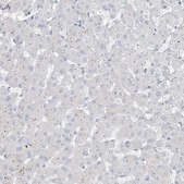 Anti-B3GNT7 antibody produced in rabbit Prestige Antibodies&#174; Powered by Atlas Antibodies, affinity isolated antibody, buffered aqueous glycerol solution