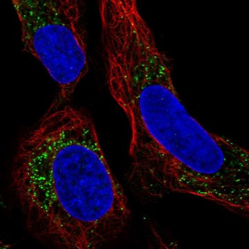 Anti-PMEPA1 antibody produced in rabbit Prestige Antibodies&#174; Powered by Atlas Antibodies, affinity isolated antibody